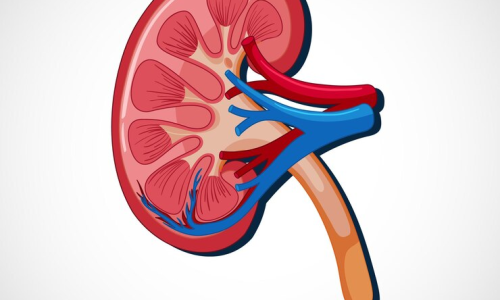 Acute Kidney Injury