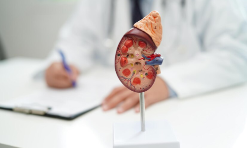 Polycystic Kidney Disease